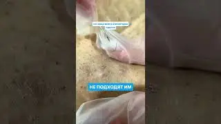 Вросшие волосы 