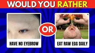 🤯 Would You Rather? | Hardest Choices Ever! | Impossible Quiz Challenge 🔥