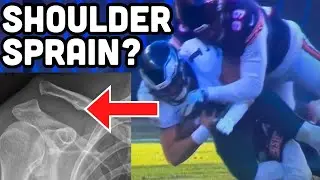 Jalen Hurts' SHOULDER Injury - What happen? Doctor Explains