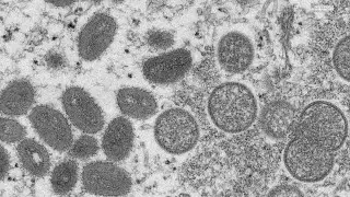 VERIFY: What is monkeypox?
