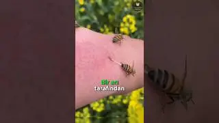 Arı Soktuğunda Ne Yapmalısınız? 🐝🚑😮
