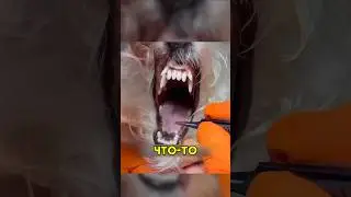 Они были удивлены от того, что увидели 