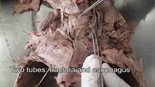 Thyroid gland - Dissection