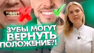 Могут ли зубы после ортодонтии вернуться в свое первоначальное положение?