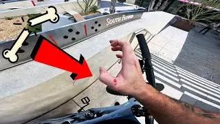 my WORST CRASH on my MTB YET..