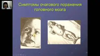 Постасфиксик синдром тугрук травмалар