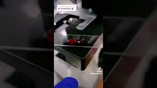 Menstrual blood under the microscope 
