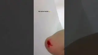 ANDREA ZÚÑIGA tiene un ACCIDENTE