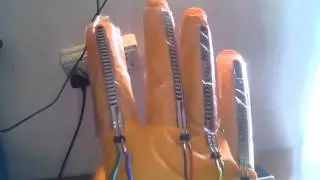 SIGN TO SPEECH CONVERSION USING ANDROID PHONE FOR DUMP PEOPLE