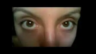 Nistagmas Nystagmus