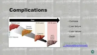 Hepatitis C video
