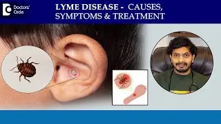 What is Lyme Disease? Tick Bite Rash | Bulls Eye Rash Treatment-Dr.Leela Mohan PVR |Doctors Circle