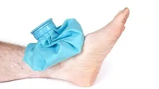 Ayağım Burkuldu Ne Yapmalıyım?