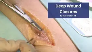 Deep Wound Closures | The Cadaver-Based Suturing Course