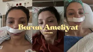 BURUN DEVİASYONU AMELİYAT SÜRECİM DEVLET|Öncesi ve sonrası, deviasyon ameliyatı tampon çıkarma