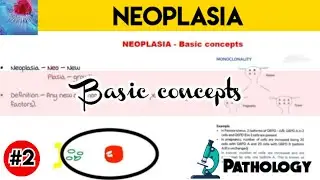 Neoplasia Basic concepts - pathology