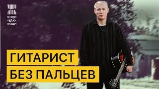 I lost my fingers, but I play the guitar