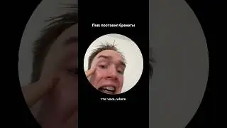 Поставил брекеты