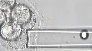 Preimplantation Genetic Diagnosis (PGD): Three Day Biopsy