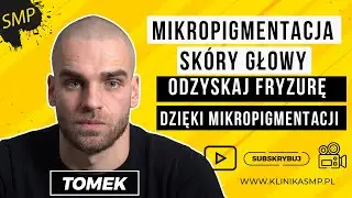 MIKROPIGMENTACJA SKÓRY GŁOWY - Odzyskaj fryzurę dzięki mikropigmentacji! KLINIKA SMP