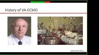 Michael Hart, MD - VA-ECMO and ECPR in Adults