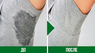 Как ИЗБАВИТЬСЯ от МОКРЫХ ПОДМЫШЕК НАВСЕГДА?!