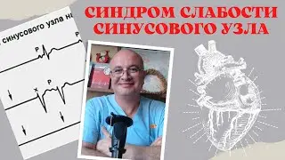 Синдром слабости синусового узла. Дисфункция синусового узла