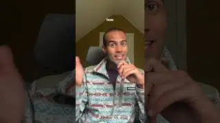 FUE hair transplant Turkey - 3 Months Update 