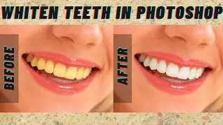 Whiten Teeth In Photoshop