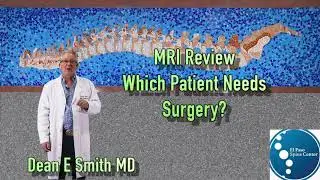 I Have A Herniated Lumbar Disc?