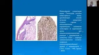 Опухолевые процессы зубо челюстной системы и системы и слюнных желез