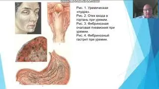 Буйрак касалликлари патоморфологияси