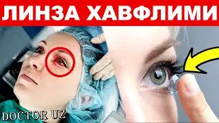 КЎЗ ЯХШИ КЎРМАСА ЛИНЗА ТАҚИШ КЕРАКМИ? КУЗ ОПЕРАЦИЯСИ ХАВФЛИ ЭМАСМИ ?
