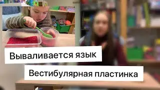 У ребёнка вываливается  язык / вестибулярная пластина/ ротовое и носовое дыхание