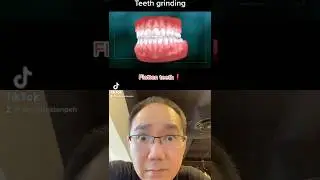 Teeth Grinding? Wear mouth guard please. 🧐