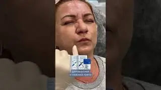 Лучшие ботулинотоксины для full face 🔝
