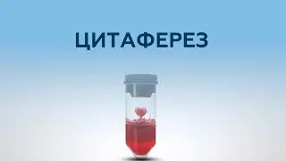 Цитаферез, как метод гемокоррекции. Когда нужно удалить из крови определенные виды клеток?