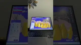 The Eggshell Technique 