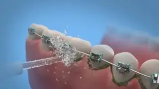 AQUAJET LD A8 (3D graphic)