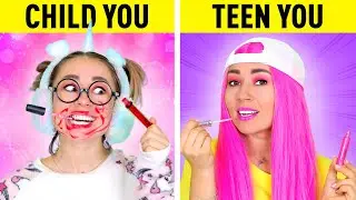 TEEN vs CHILD || La La Life Gold Relatable Musical