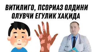 БОЛАМДА ОҚ ДОҒЛАР КЎПАЙМАСИН ДЕСАНГИЗ ШУ ТАБИИЙ МАҲСУЛОТНИ ТЕЗ ТЕЗ ЕДИРИБ ТУРИНГ / ИСЧАНОВ