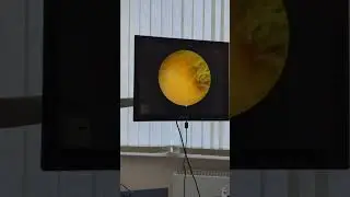 #shortsvideo