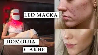 ЧУДО МАСКА ОТ АКНЕ | Стоит ли покупать Impulse Derma Pro маску?