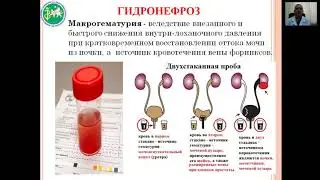 Обструктивные уропатии у детей часть 1