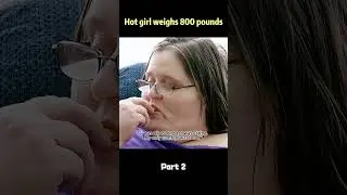 Hot girl weighs 800 pounds