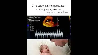 МАЛУМОТ УЧУН ФАКАТ ТЕЛЕГРАМДАН ЁЗИНГ: +998950014004 #Узи #беременность #гинекология #Хомиладорлик