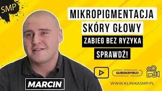 MIKROPIGMENTACJA SKÓRY GŁOWY - Nieinwazyjny zabieg bez ryzyka! KLINIKA SMP