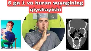5 ga 1 va burun suyagining qiyshayishi