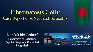 Fibromatosis Colli || Ultrasound || Case 340