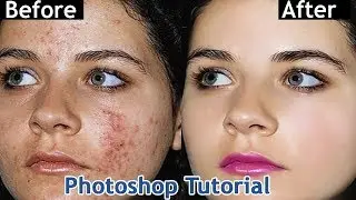 Photoshop Tutorial~~How to Quickly Smooth Skin clean face and Remove pimple Blemishes & Scars